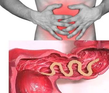 Menschliche Parasiten