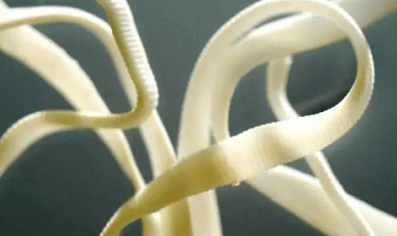 Wie man Parasiten aus dem menschlichen Körper beseitigt