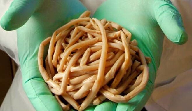 Parasiten aus dem Körper beseitigen